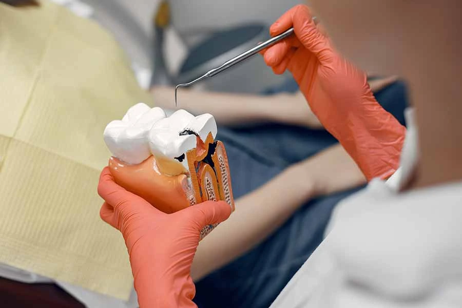 Painless Root Canal Treatment in Tripunithura, Kochi